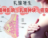 乳腺增生